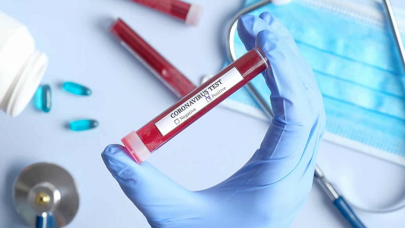 Anvisa aprova testes rápidos para covid-19 em farmácias
