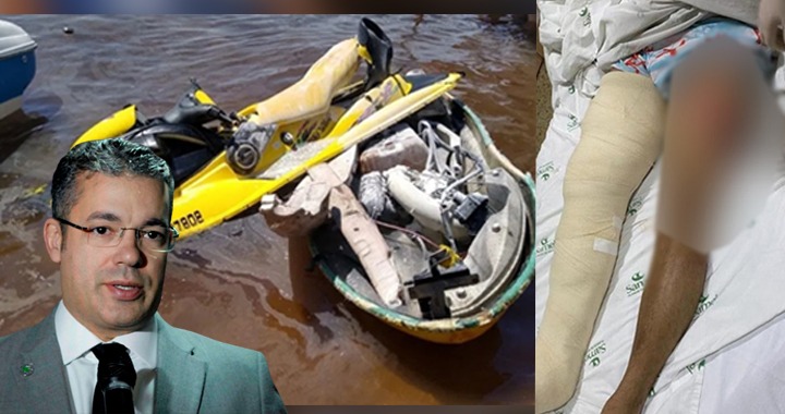 Josué Neto segue internado após acidente de jet ski no Tarumã em Manaus
