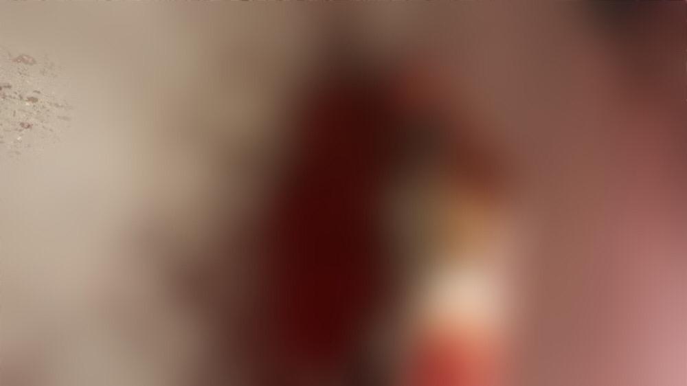 Homem é assassinado e tem cabeça esmagada, no Amazonas; imagens fortíssimas